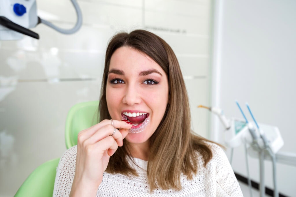 Best Practices for Keeping Aligners Clean