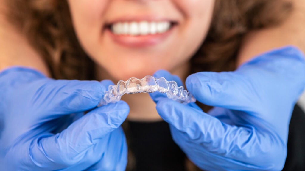 Best Practices for Keeping Aligners Clean